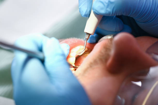 Best Broken or Cracked Tooth Emergency Dentist in Mannington, WV
