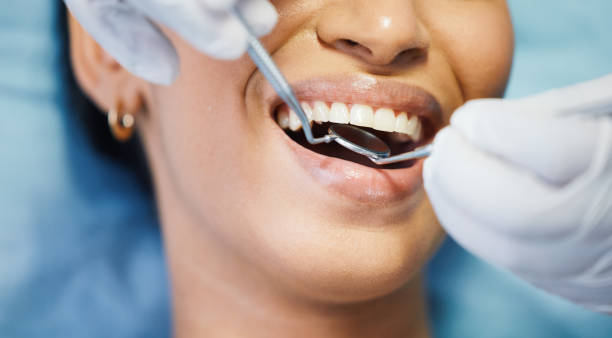 Best Emergency Dentist for Lost Fillings or Crowns in Mannington, WV