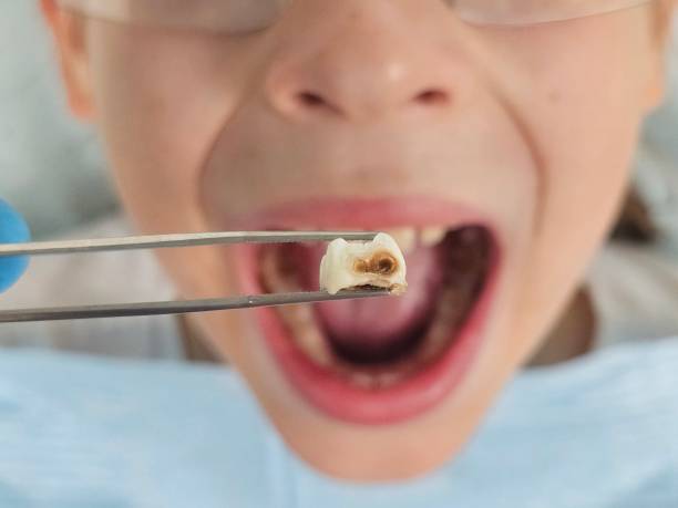 Best Emergency Dentist for Special Needs Patients in Mannington, WV