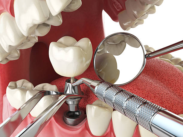 Best Emergency Dental Services for Seniors in Mannington, WV